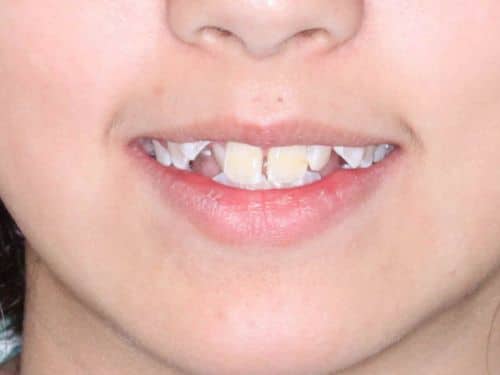 Foto 4 Antes