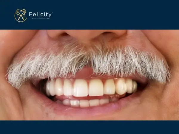 Protese Fixas(Pontes) em Boituva e região - Felicity (1)