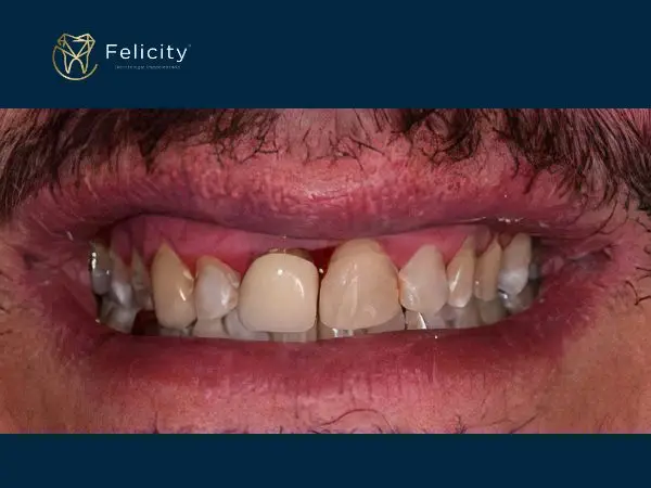Sorrisos Renovados é em Boituva